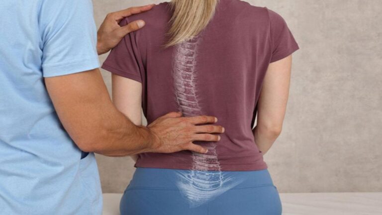 Skolyoz nedir? Skolyozun semptomları, nedenleri ve yöntemleri nelerdir?