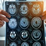 Harvard'dan şaşırtıcı yeni araştırmalar: Alzheimer tedavisine karşı yeni umut! Uzmanlar: “Bu harika bir dönüm noktası olabilir”