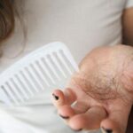 “Saç dökülmesi şikayetiniz varsa! Genetik değil, yanlış alışkanlıklarınız suçlu olabilir”